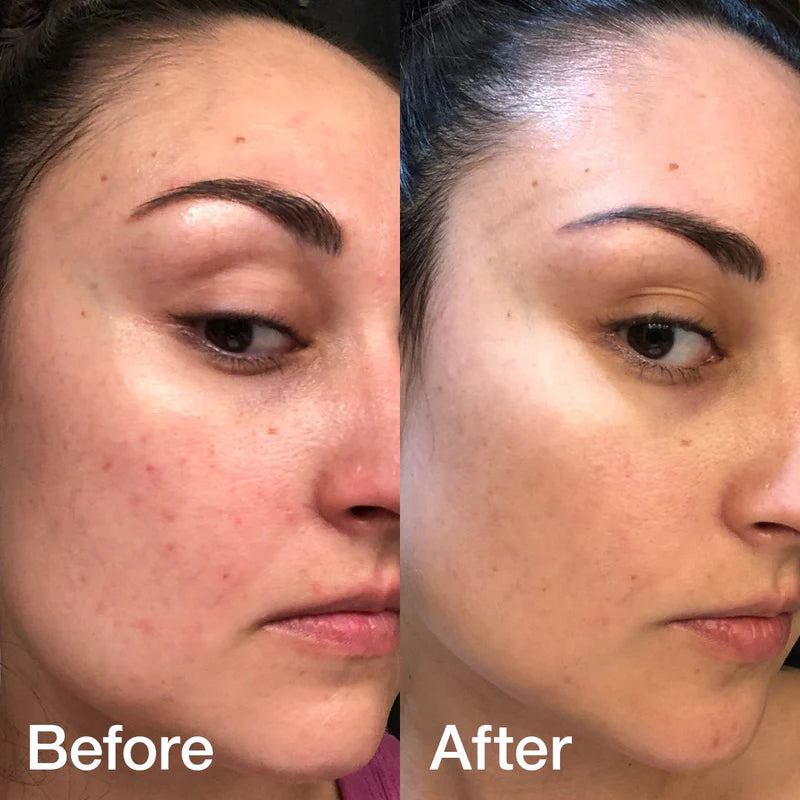 Medicube Triple Collagen Toner