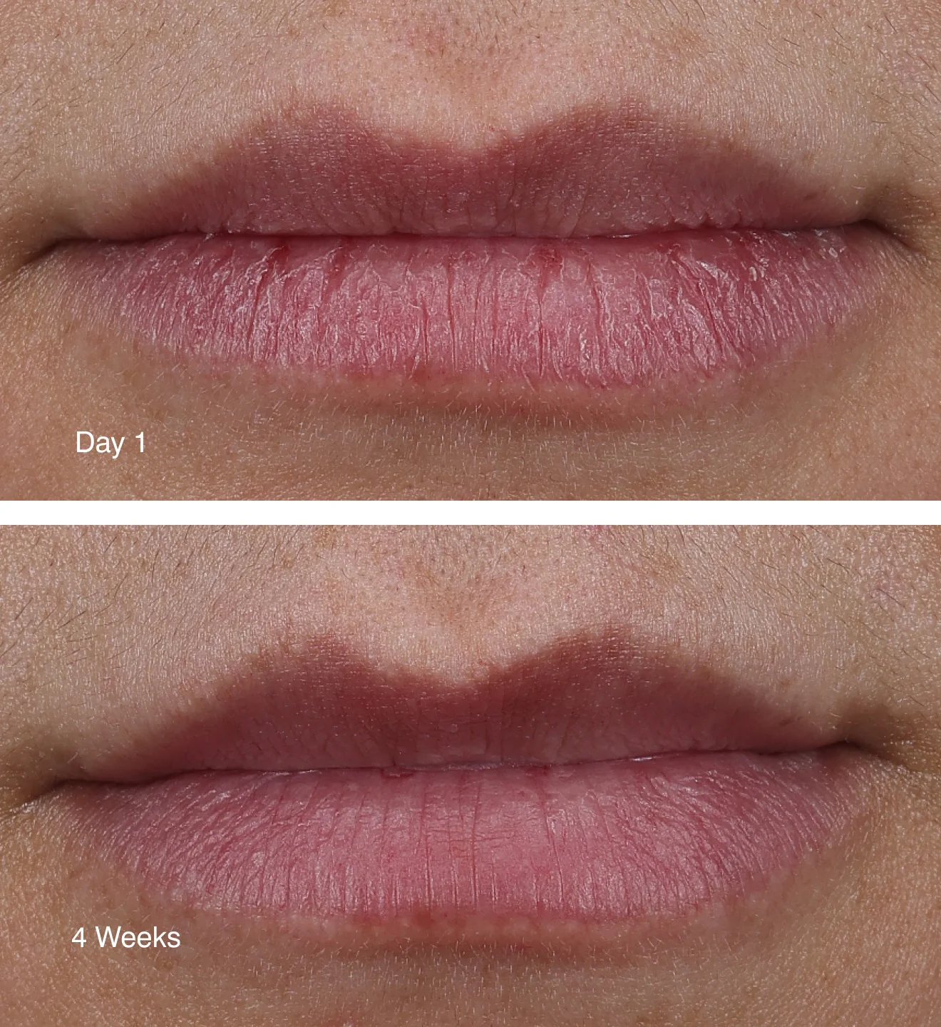 Rhode lip peptide